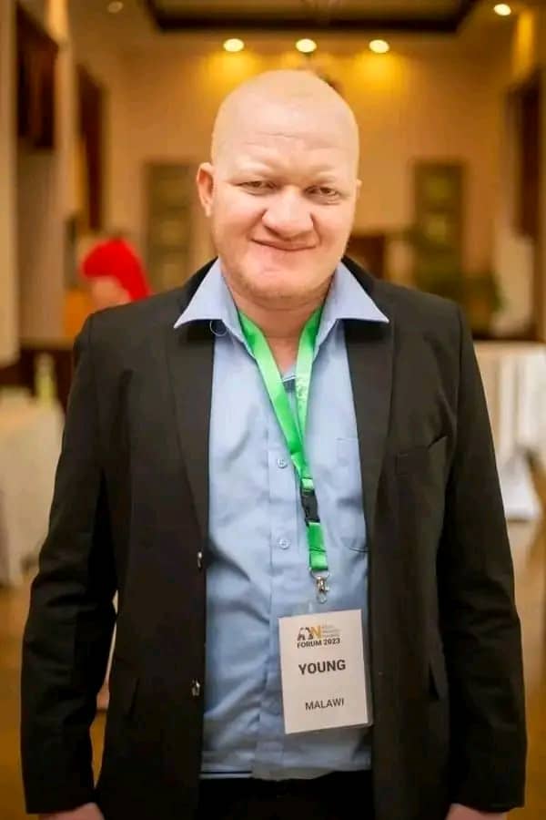 Mutharika urged to address renewed fears over safety of persons with albinism